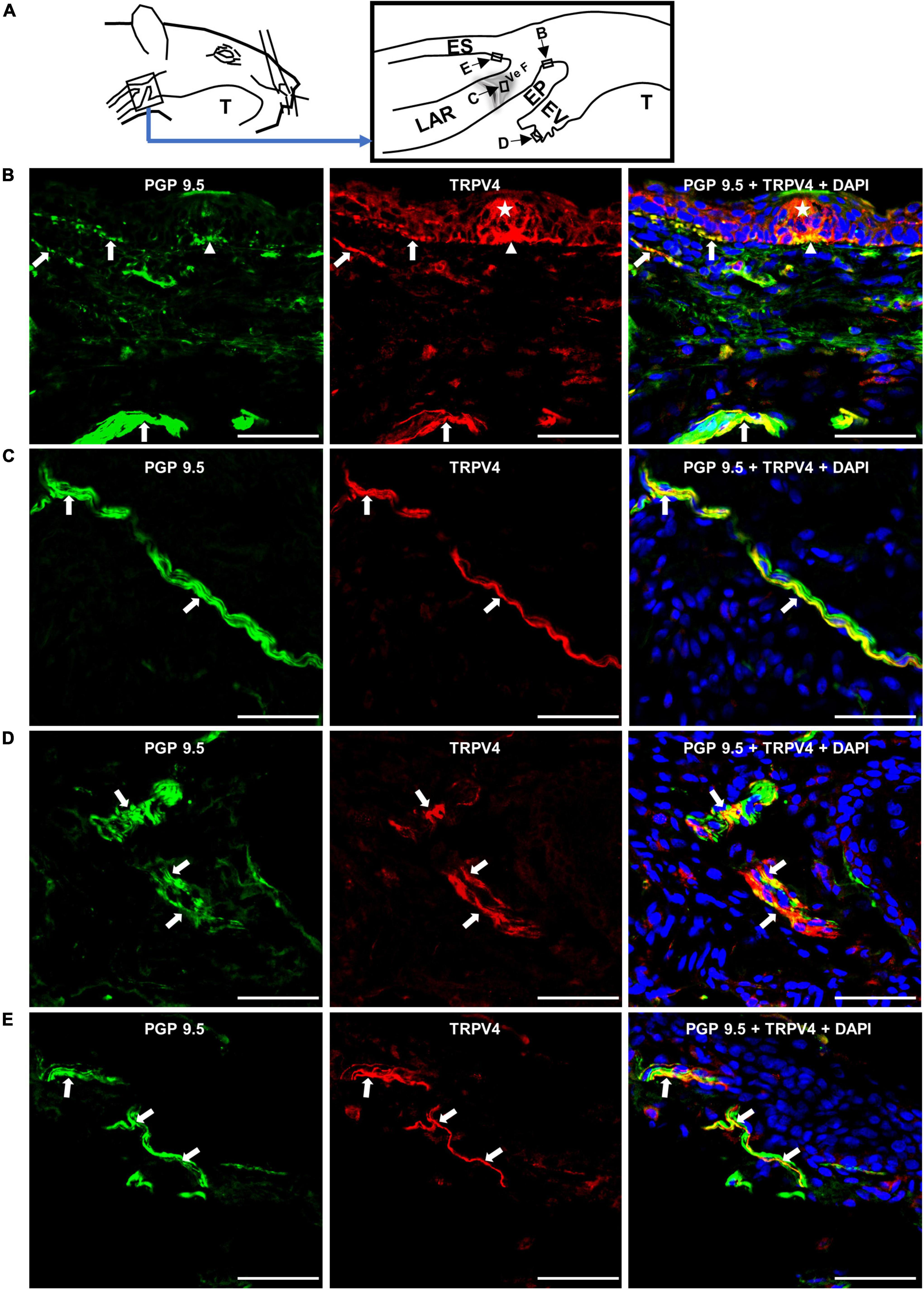 Pharmacological activation of transient receptor potential vanilloid 4 promotes triggering of the swallowing reflex in rats